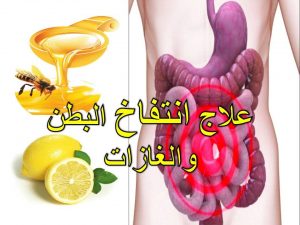 علاج الانتفاخ