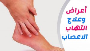 علاج التهاب الاعصاب