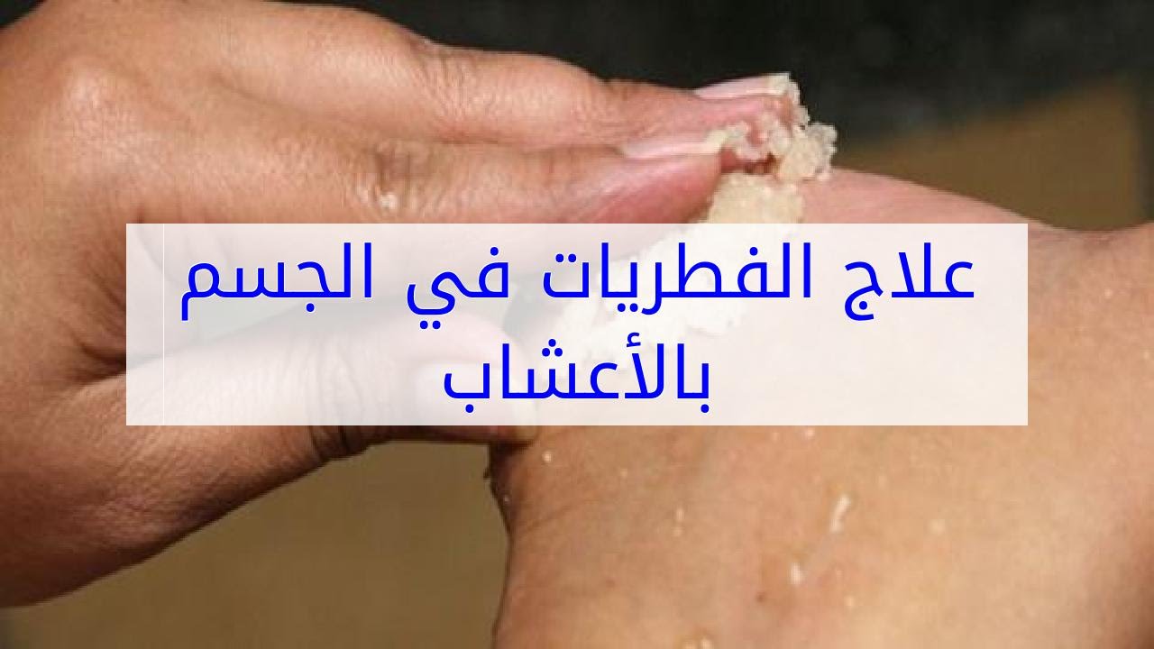 شكل فطريات المهبل بالصور