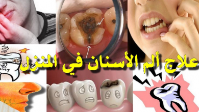 ما هي الطريقة المثلى لـ علاج الم الاسنان ؟