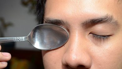 ما هي الطريقة الصحيحة لـ علاج انتفاخ العين ؟