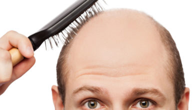 علاج لتساقط الشعر ما بين خيارات منزلية وخيارات دوائية
