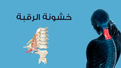 علاج خشونة الرقبة ما بين أساليب علاجية منزلية وأساليب علاجية دوائية