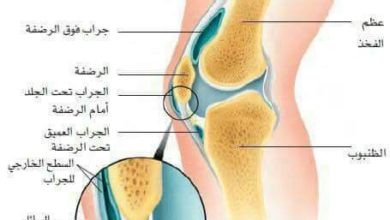 علاج الام الركبة ما بين خيارات علاجية دوائية طبية وخيارات علاجية منزلية طبيعية وخيارات الجراحة