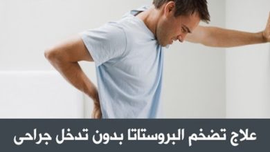 دواء سيلدوكير Sildocare لـ علاج حالات تضخم البروستاتا