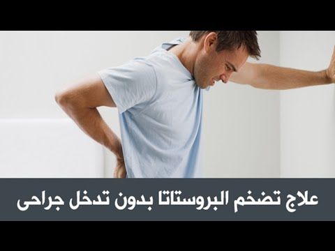 علاج تضخم البروستاتا بدون تدخل جراحي