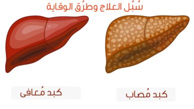 سبل العلاج وطرق الوقاية من دهون الكبد