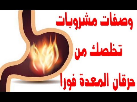 علاج حرقان المعدة