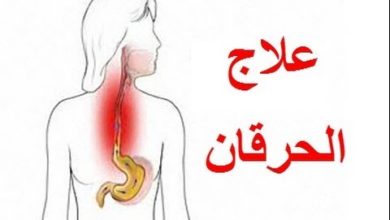 علاج حرقان المعدة