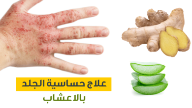 علاج حساسية الجلد ما بين طرق علاجية منزلية وطرق علاجية دوائية