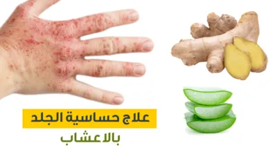 علاج حساسية الجلد ما بين طرق علاجية منزلية وطرق علاجية دوائية