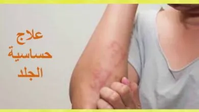 علاج حساسية الجلد