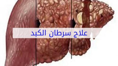 علاج سرطان الكبد وكيفية الوقاية منه وطريقة التعامل مع الأعراض