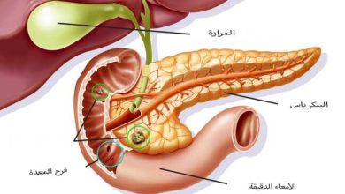 دواء جاستروتيدين Gastrotidine لـ علاج قرحة المعدة وارتجاع المريء والحموضة