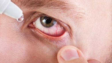 طرق علاج حساسية العين
