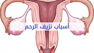 علاج نزيف الرحم