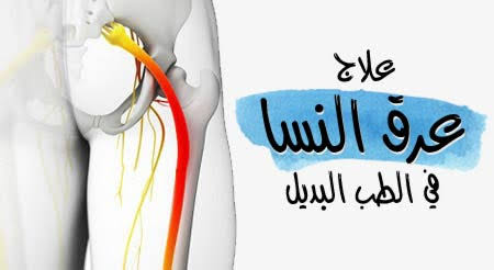 علاج عرق النسا في الطب النبوي