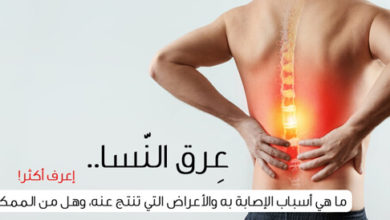 علاج عرق النسا في الطب النبوي