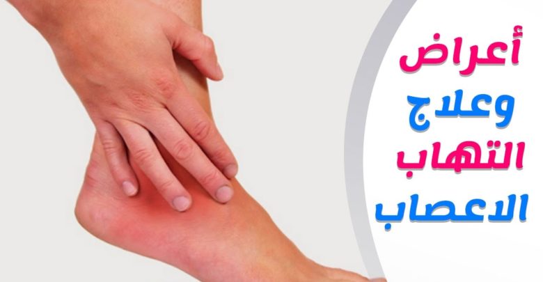 علاج التهاب الاعصاب والعضلات