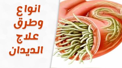 علاج الديدان المعوية