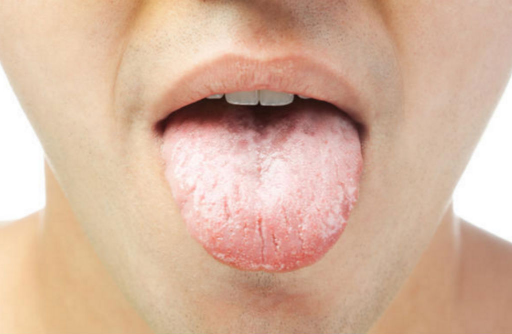 سرطان الفم قد يصيب اي جزء من اجزاء الفم