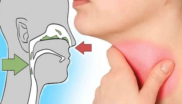 سيلجون اقراص لعلاج الكحة