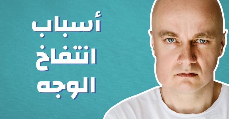 معلومات عن انتفاخ الوجه