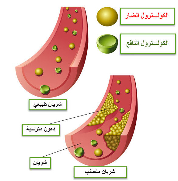 الكوليسترول النافع والضار 