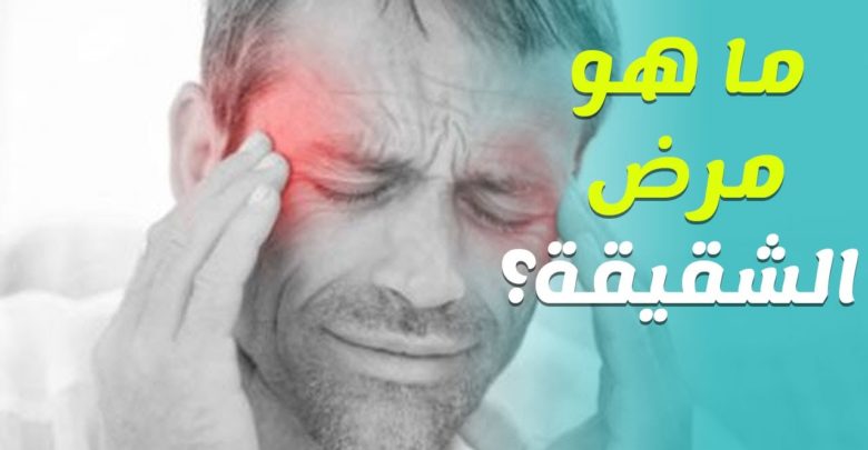 الصداع النصفي