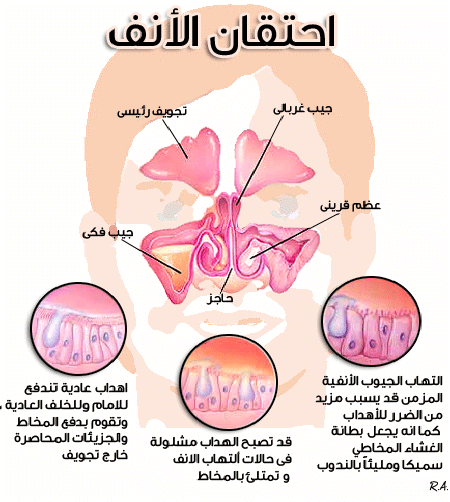 احتقان الانف 