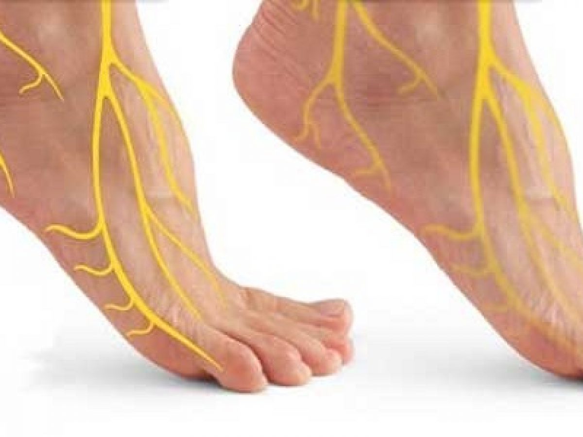 اعراض التهاب الاعصاب في القدم