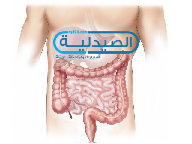 علاج مشاكل القولون