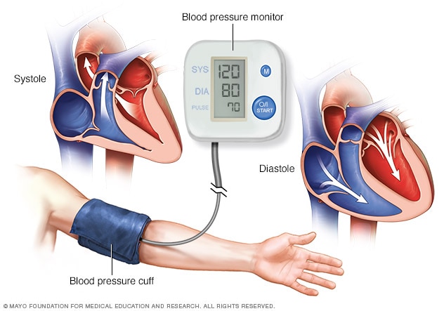 قياس نسبة ضغط الدم