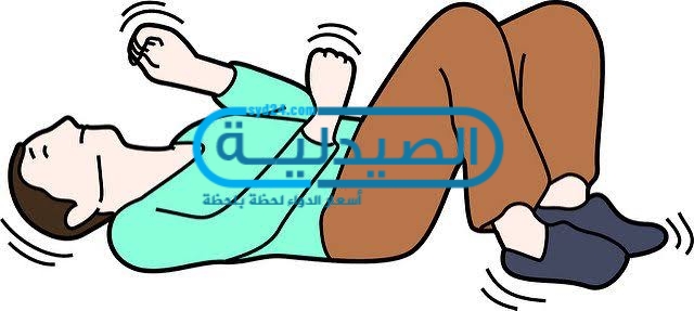 أسباب وأعراض الصرع