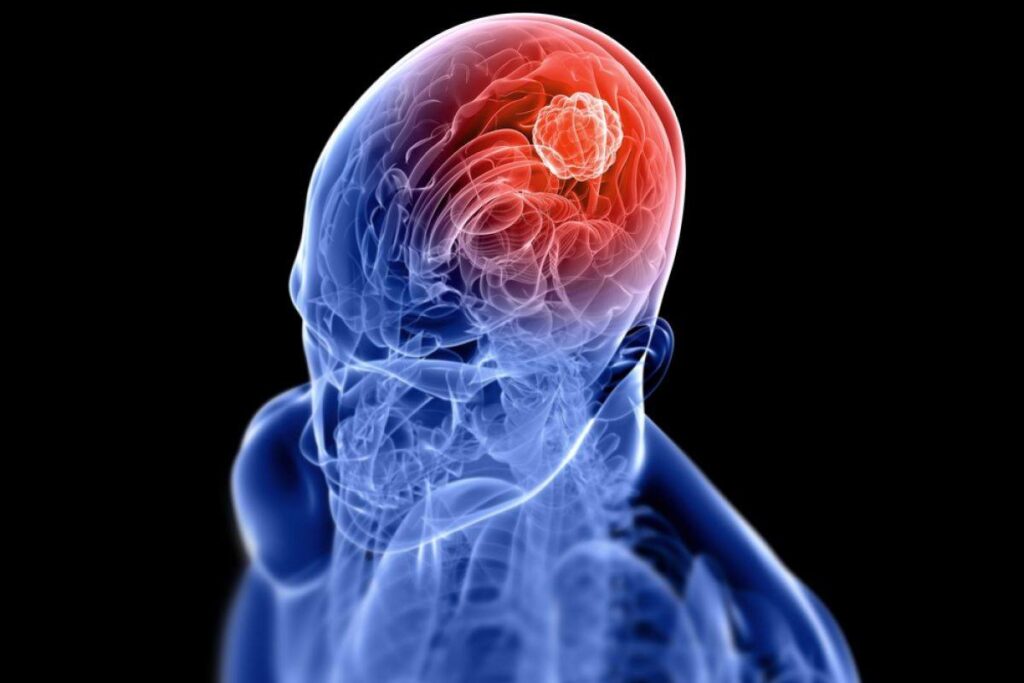 معلومات عن سرطان الرأس و العنق