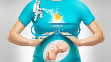 علاج الحموضة عند المرأة الحامل