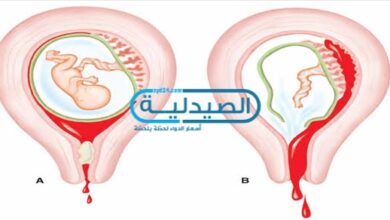 طرق الإجهاض في فترات الحمل المختلفة