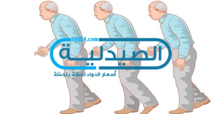 علاج مرض باركنسون