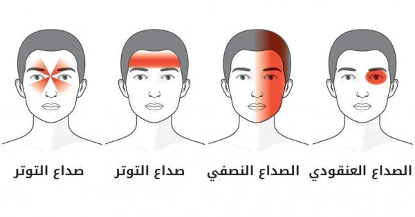 انواع الصداع 