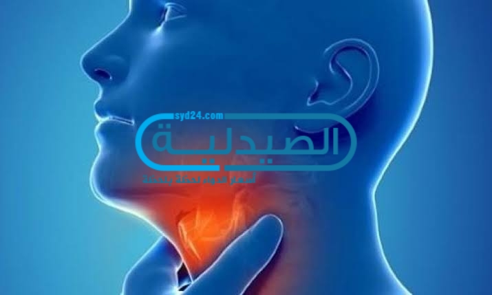 طريقة علاج احتقان الحلق