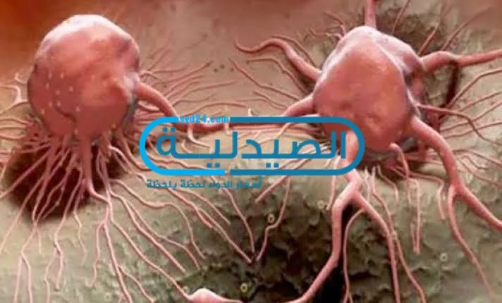 نسب الشفاء من السرطان