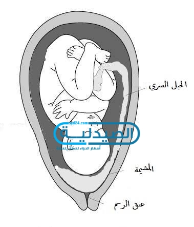 الوضع الطبيعي لـ المشيمة