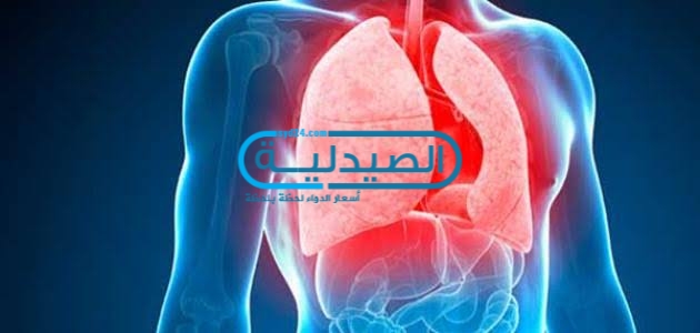 علاج السل