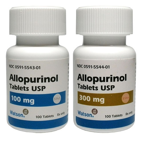 الأعراض الجانبية لأقراص ألوبيورينول