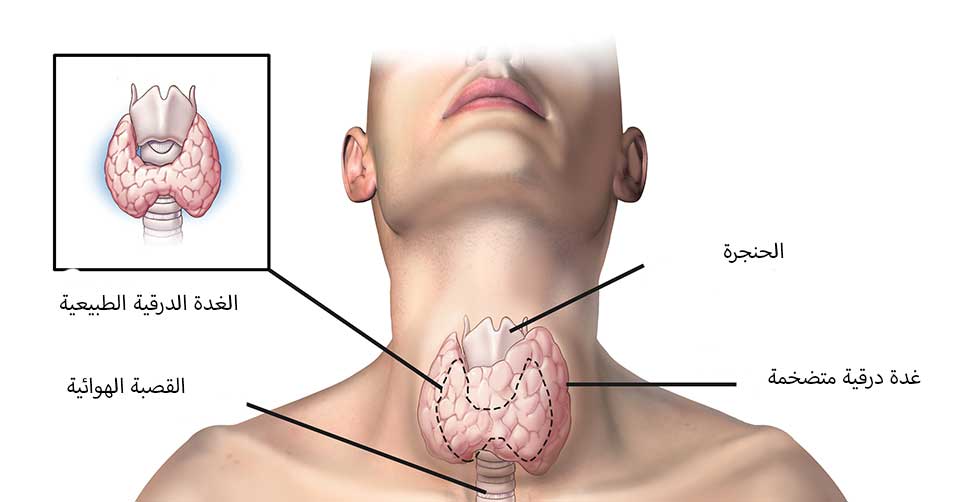 طرق تشخيص سرطان الغدة الدرقية