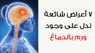 أعراض سرطان الرأس المبكرة