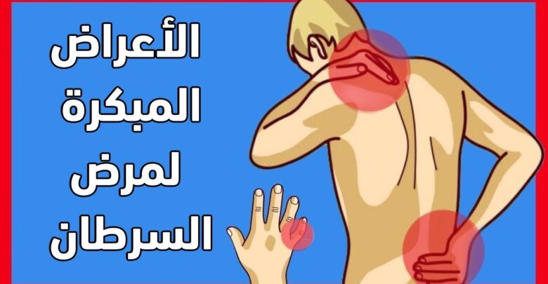 اعراض مرض الكانسر