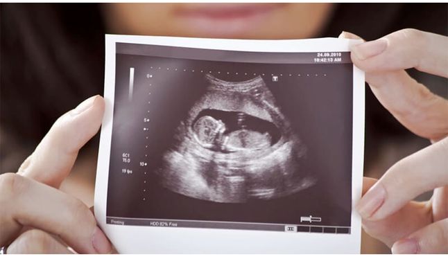 شكل الجنين الانثى في الشهر الثاني 
