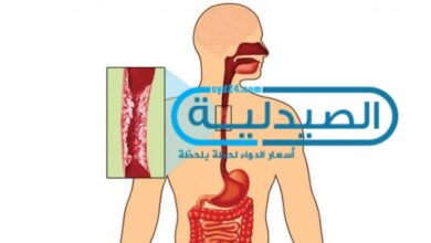 أعراض سرطان المريء