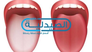 علاج فطريات الفم الصيدلية